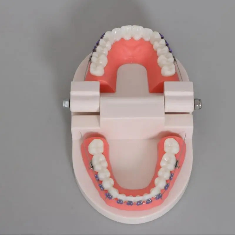 Orthodontic Teeth Model with Brackets, Arch Wire & Buccal Tube Dental Teaching Model Babs