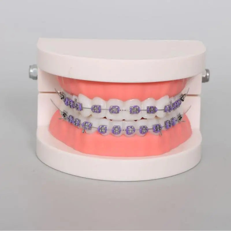 Orthodontic Teeth Model with Brackets, Arch Wire & Buccal Tube Dental Teaching Model Babs 1pc