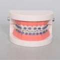 Orthodontic Teeth Model with Brackets, Arch Wire & Buccal Tube Dental Teaching Model Babs 1pc