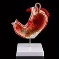 Human Anatomy Stomach Model – Gastric Pathology Teaching Aid Anatomy Teaching Model Babs 1pc