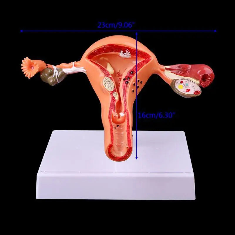Uterus & Ovary Cross-Section Anatomy Model – Medical Study Tool Anatomy Model Babs