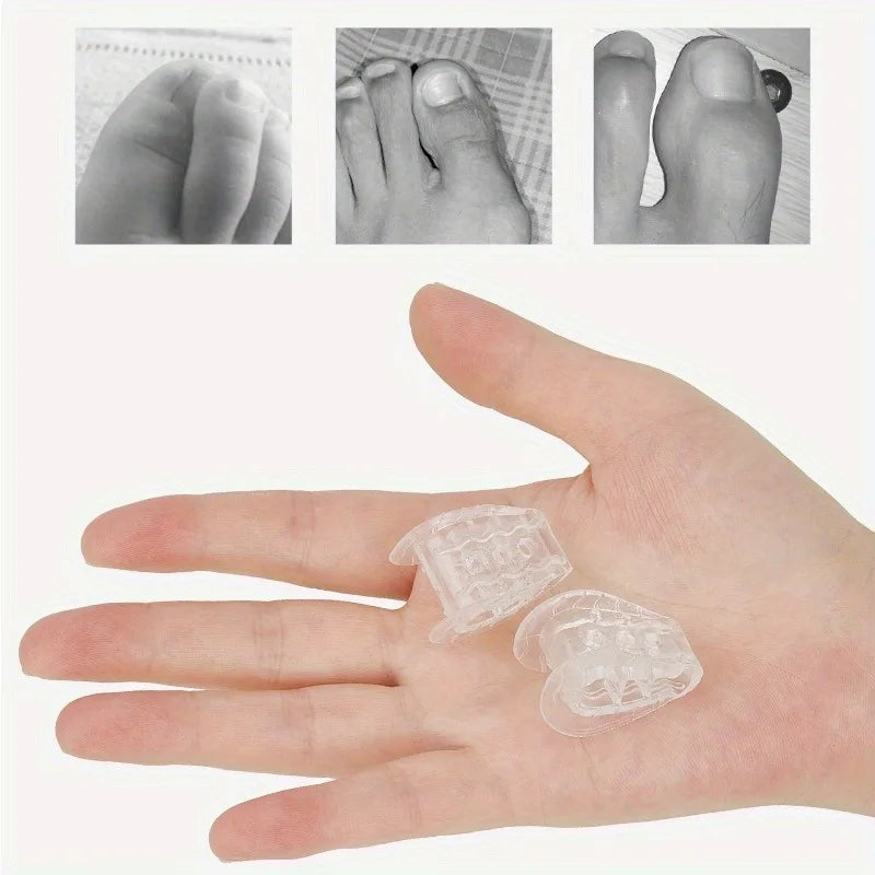 Toe Separator Splitter & Bunion Corrector – 2pc or 4pc Set Toe Separator Splitter Babs