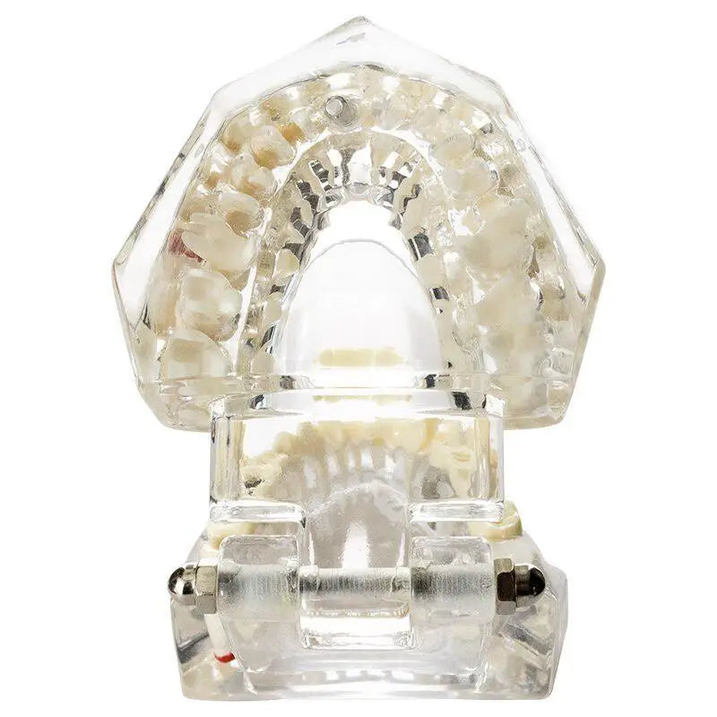 Dental Implant & Bridge Teaching Model – 28 Tooth Set Dental Teaching Model Babs
