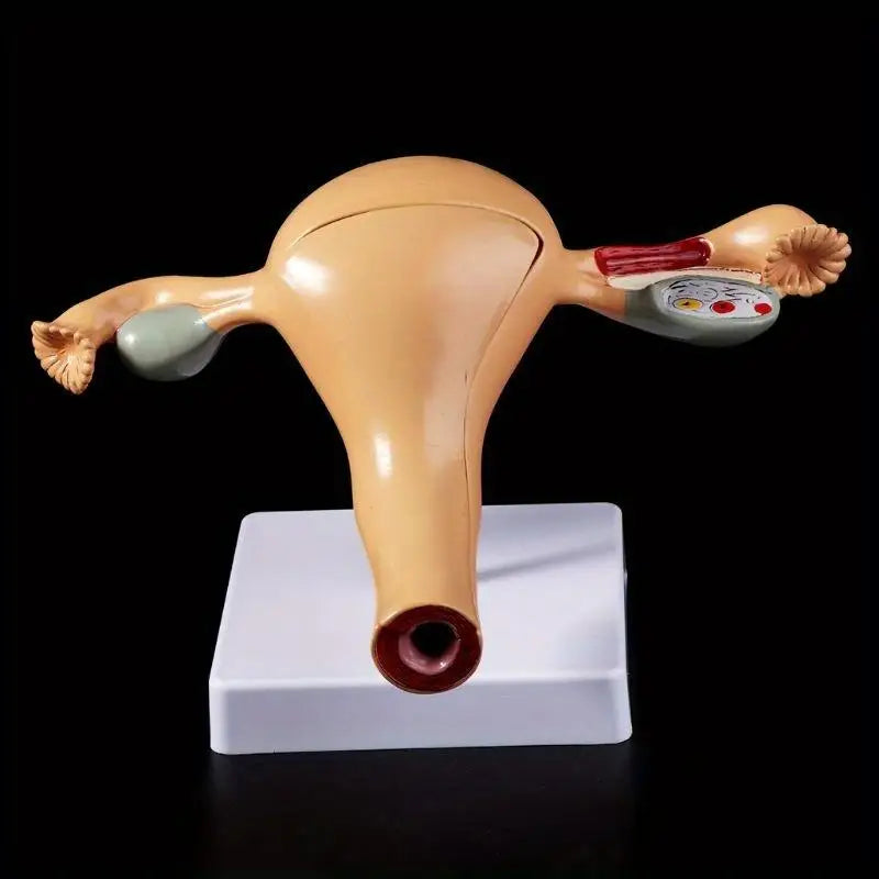 Uterus & Ovary Anatomical Teaching Model | Gynecology Anatomical Teaching Model Babs