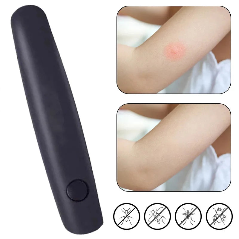 Electric Insect Bite Itch Relief Pen – Kids & Adults Outdoor Itch Relief Pen Babs