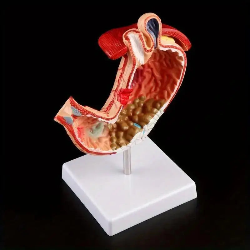 Human Anatomy Stomach Model – Gastric Pathology Teaching Aid Anatomy Teaching Model Babs
