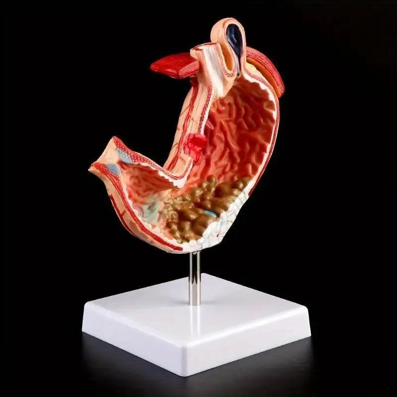 Human Anatomy Stomach Model – Gastric Pathology Teaching Aid Anatomy Teaching Model Babs
