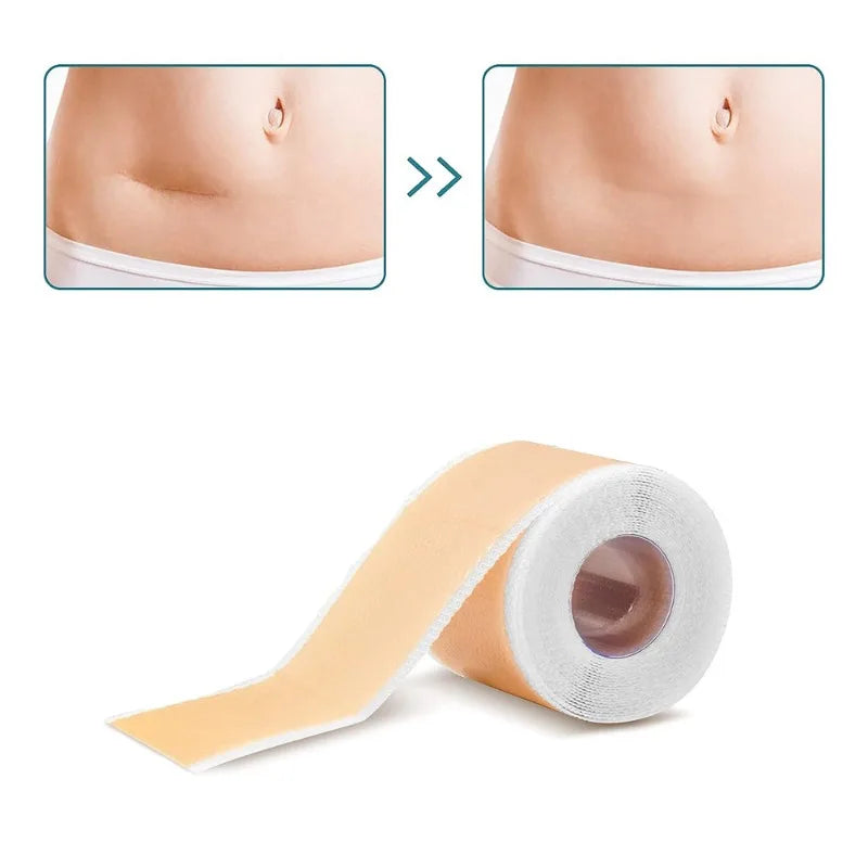 Silicone Scar Gel Sheets Roll – Reusable 4×150cm Strips Silicone Scar Sheets Babs