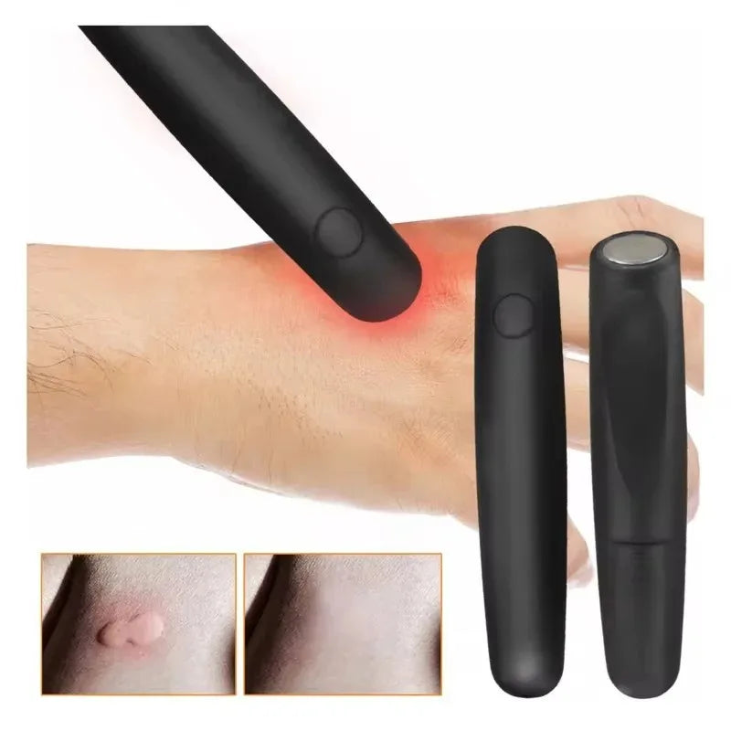 Anti-Itch Pen for Insect & Mosquito Bites – Drug-Free Anti-Itch Pen Babs