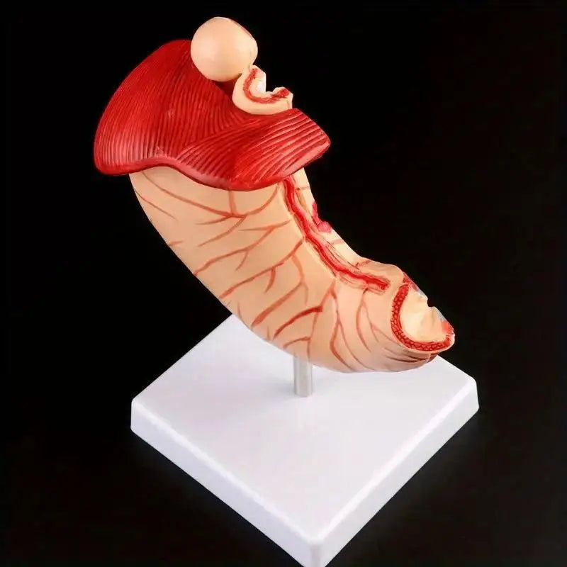 Human Anatomy Stomach Model – Gastric Pathology Teaching Aid Anatomy Teaching Model Babs