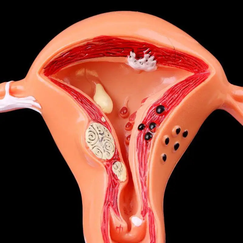 Uterus & Ovary Cross-Section Anatomy Model – Medical Study Tool Anatomy Model Babs