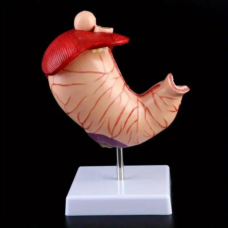 Human Anatomy Stomach Model – Gastric Pathology Teaching Aid Anatomy Teaching Model Babs