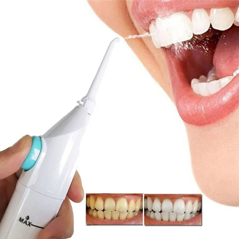 Portable Electric Water Flosser – Pulse Jet Oral Irrigator Oral Water Flosser Babs