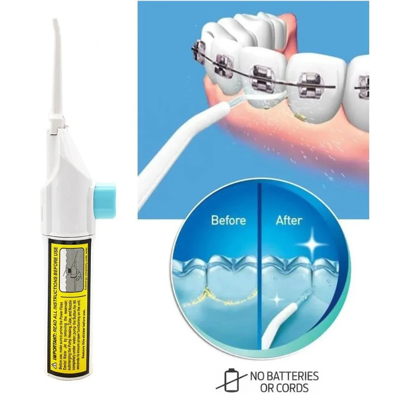 Portable Electric Water Flosser – Pulse Jet Oral Irrigator Oral Water Flosser Babs