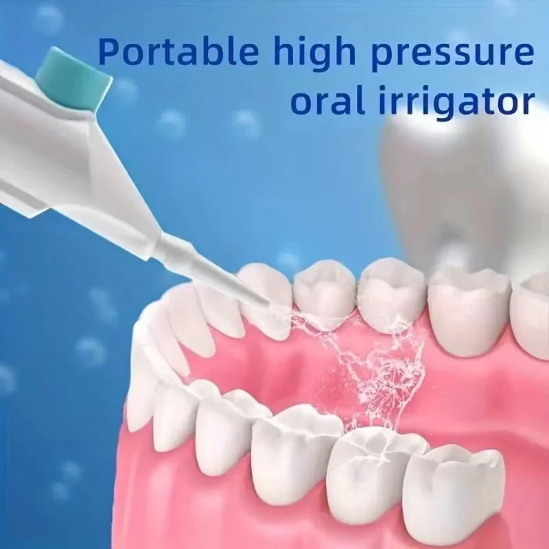 Portable Manual High Pressure Oral Irrigator Water Flosser Oral Irrigator Babs