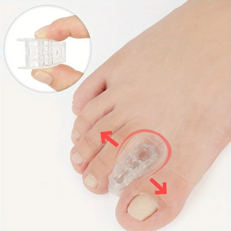 Toe Separator Splitter & Bunion Corrector – 2pc or 4pc Set Toe Separator Splitter Babs