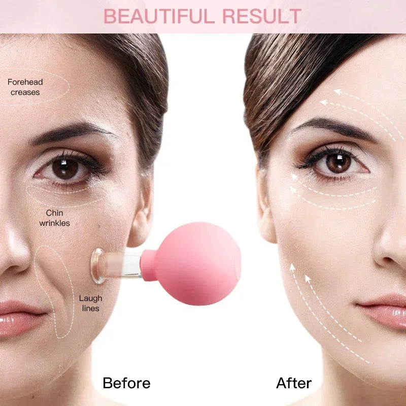 Vacuum Cupping Massage Cups – Face & Body Skin Lifting Tool Cupping Massage Tool Babs