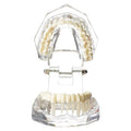 Dental Implant & Bridge Teaching Model – 28 Tooth Set Dental Teaching Model Babs 1pc