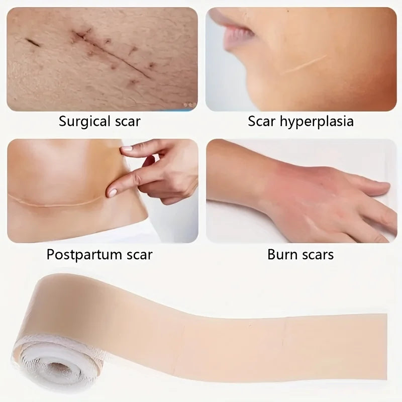 Silicone Scar Tape Roll – Gel Adhesive Cover Up Tape for Skin Silicone Scar Tape Babs