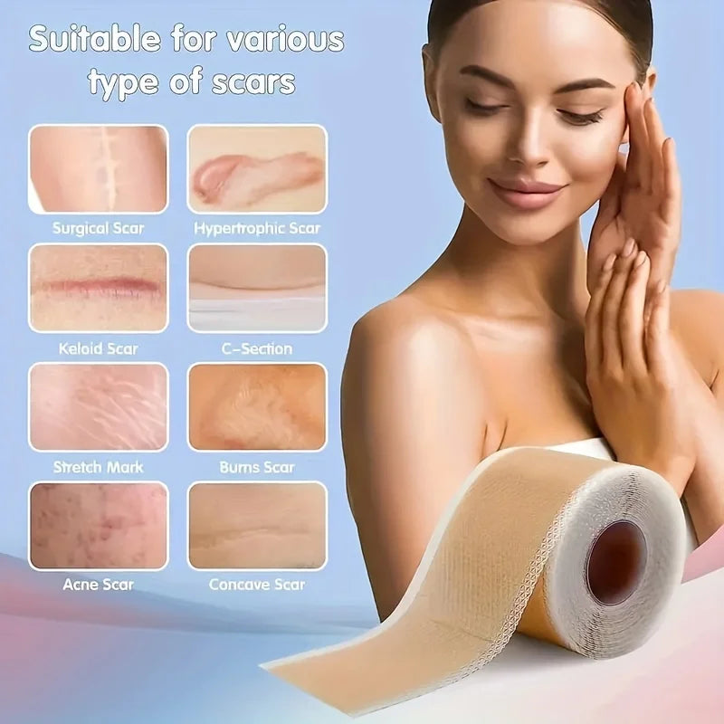 Silicone Scar Tape Roll – Gel Adhesive Cover Up Tape for Skin Silicone Scar Tape Babs