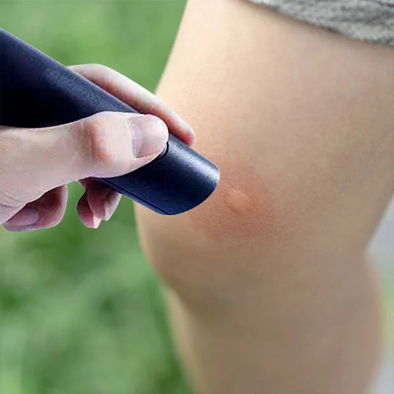 Electric Insect Bite Itch Relief Pen – Kids & Adults Outdoor Itch Relief Pen Babs