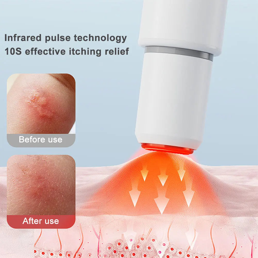 Portable Electric Itch Relief Pen for Insect & Mosquito Bites Itch Relief Pen Babs