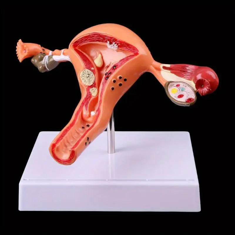 Uterus & Ovary Cross-Section Anatomy Model | Medical Study Tool Anatomy Model Babs 1pc