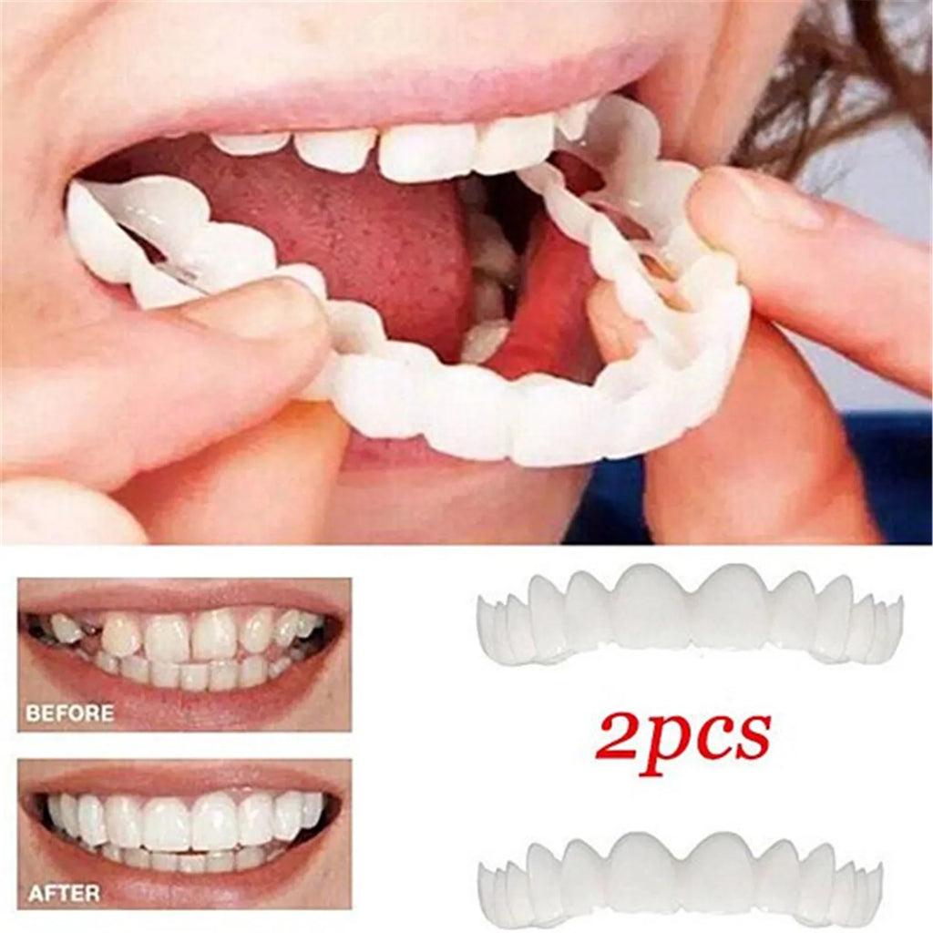 2-Piece Temporary Tooth Veneer Kit – Upper & Lower Jaw Temporary Tooth Veneer Babs