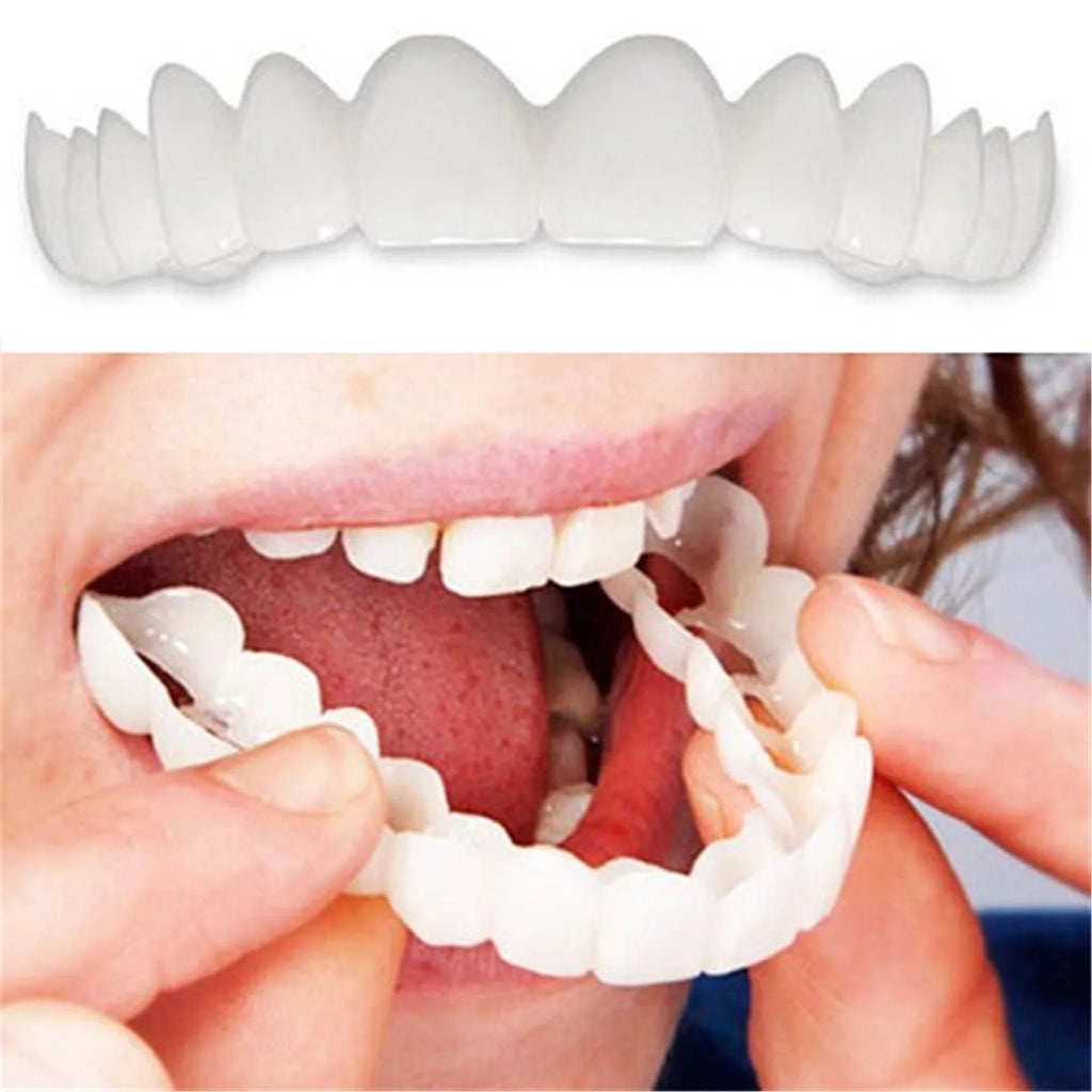 2-Piece Temporary Tooth Veneer Kit – Upper & Lower Jaw Temporary Tooth Veneer Babs