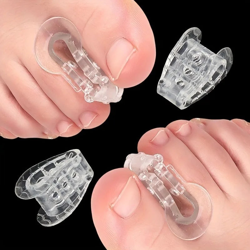 Toe Separator Splitter & Bunion Corrector – 2pc or 4pc Set Toe Separator Splitter Babs 4pcs