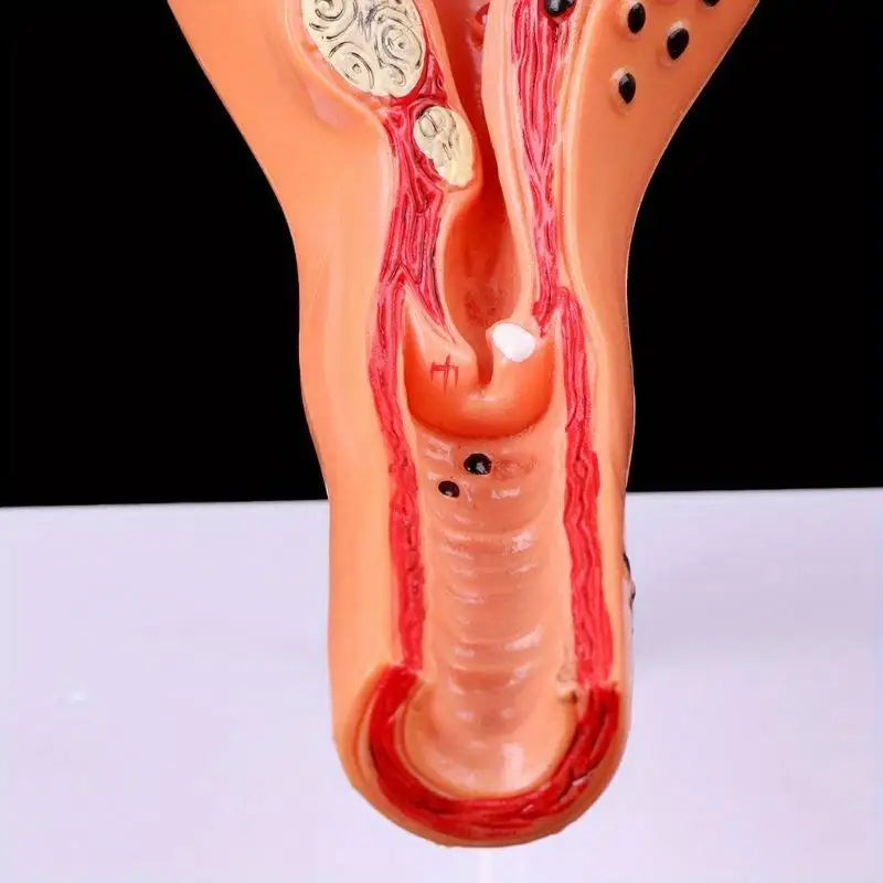 Uterus & Ovary Cross-Section Anatomy Model | Medical Study Tool Anatomy Model Babs